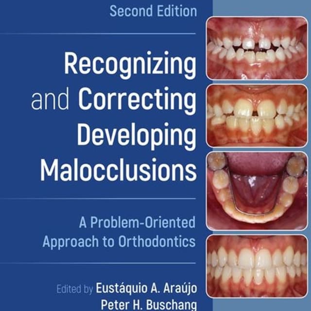 Recognizing and Correcting Developing Malocclusions: A Problem-Oriented Approach to Orthodontics