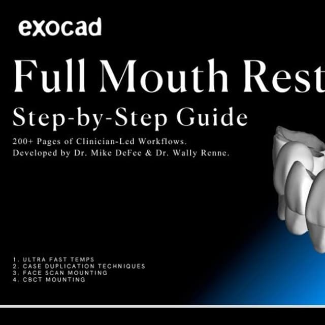 Full Mouth Restorations: Step-by-Step Guide