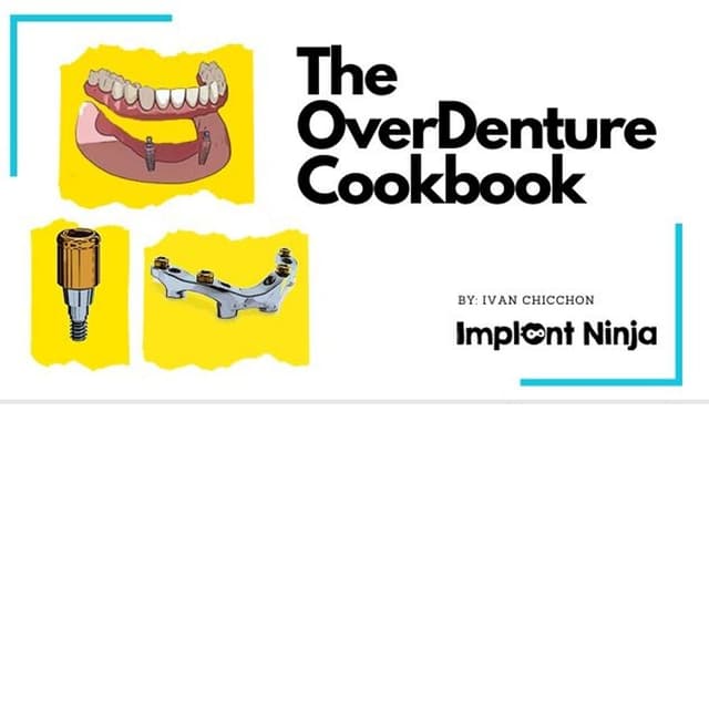 The OverDenture Cookbook