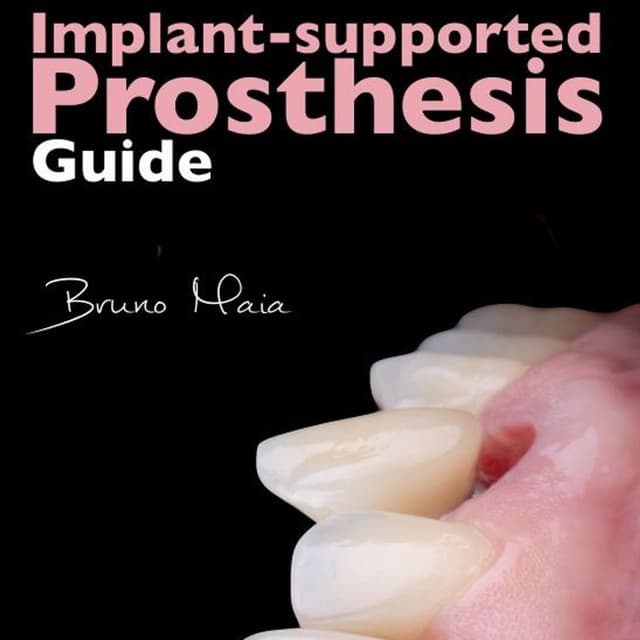 Implant-Supported Prosthesis Guide