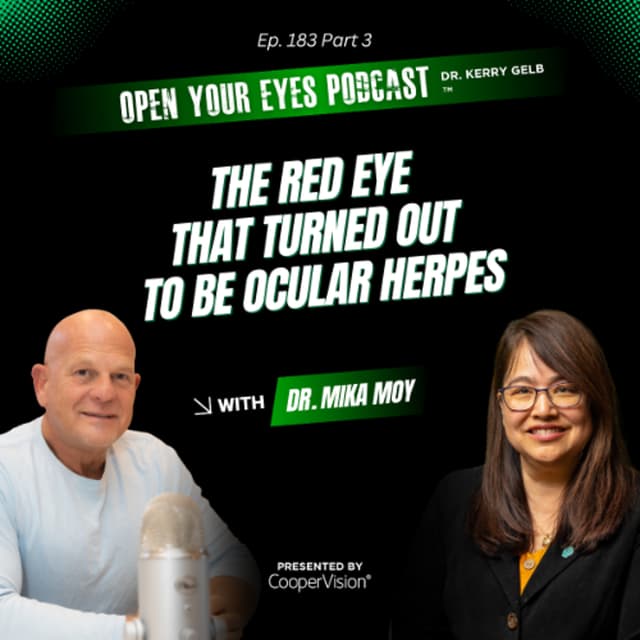 Ep. 183 Part 3 "The Red Eye That Turned Out to Be Ocular Herpes" - Dr. Mika Moy