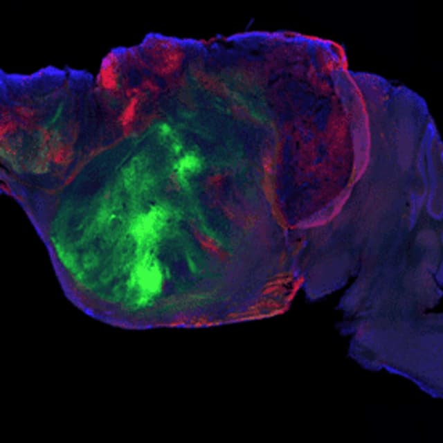 Lab Grown Brain Tissue Sparks Debate, Bolivia Unveils Leopardus Tilcayo, New mRNA Flu Vaccine Boosts Immunity, EU Faces Vaccine Crisis, and more...