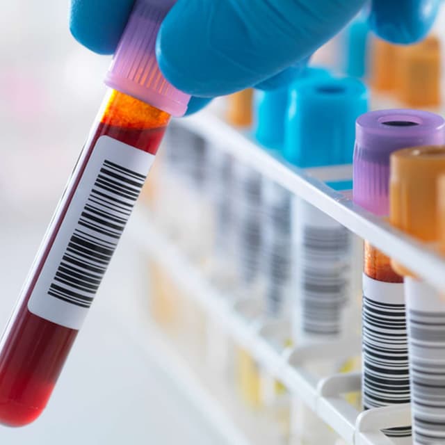 Blood Test Predicts Alzheimer's Risk, New Primate Species Likweli Emerges, Hillsborough Meteorite Reveals Origins, ISRO Tightens Rules as Scientists Exit, and more...